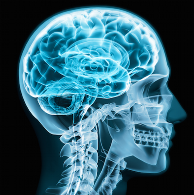 Nootropics for Lucid Dream Induction